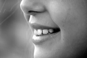 Read more about the article Fehlstellungen der Kiefer und Zähne frühzeitig erkennen